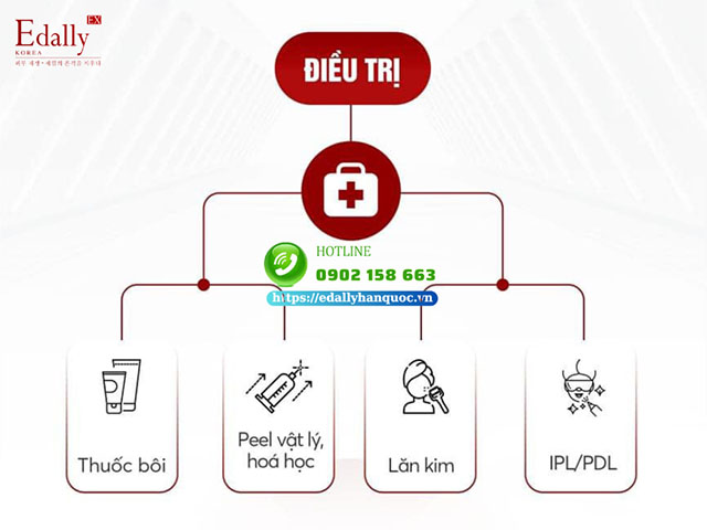 Nguyên tắc khi điều trị mụn trứng cá