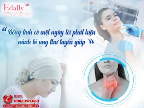 Hướng Dẫn Điều Trị Ung Thư Tuyến Giáp Thể Biệt Hóa (Thể Nhú Và Thể Nang)