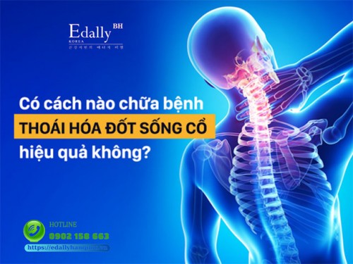 Điều Trị Thoái Hóa Đốt Sống Cổ Như Thế Nào?