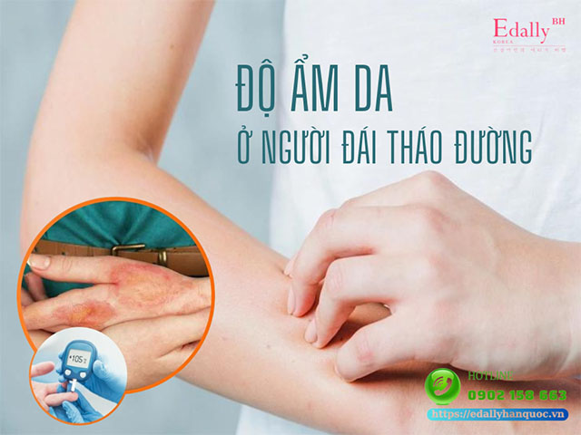 Độ ẩm của da ở người mắc bệnh đái tháo đường thay đổi ra sao?