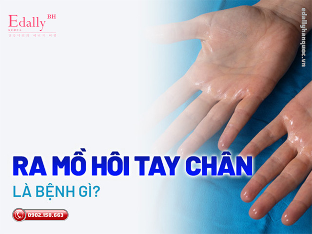 Đổ mồ hôi tay chân là bệnh gì và có chữa khỏi dứt điểm hoàn toàn được không?