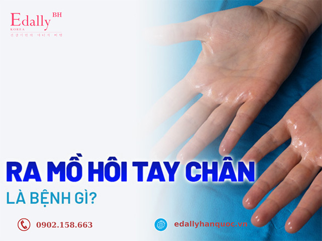 Đổ mồ hôi bất thường ở lòng bàn tay và lòng bàn chân cảnh báo điều gì?