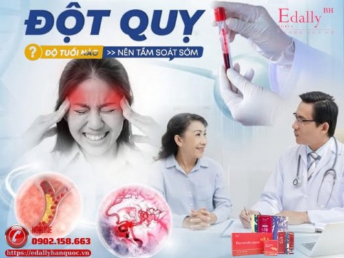 Độ Tuổi Nào Nên Tầm Soát Sớm Đột Quỵ?