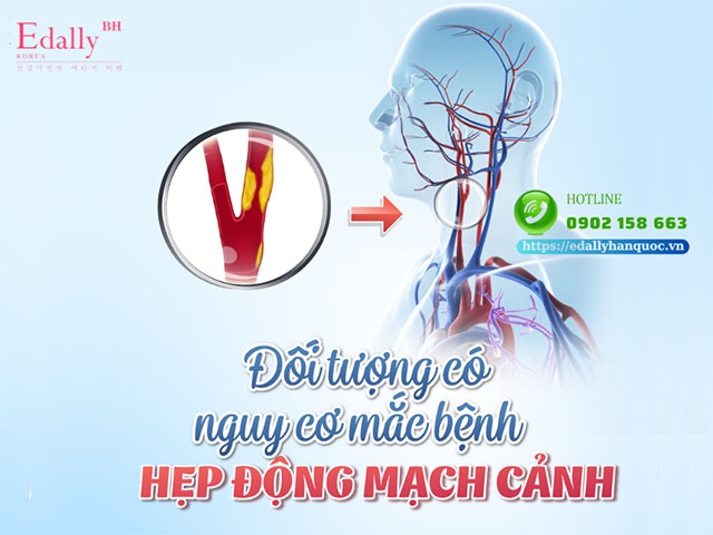 Những ai có nguy cơ hẹp động mạch cảnh?