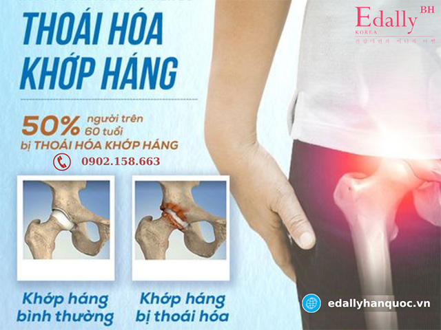 Người cao tuổi là đối tượng có nguy cơ bị thoái hóa khớp háng cao nhất