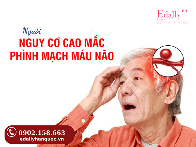 Đối tượng có nguy cơ cao mắc bệnh túi phình động mạch não