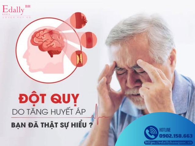 Đột quỵ do tăng huyết áp - Bạn đã thực sự hiểu?