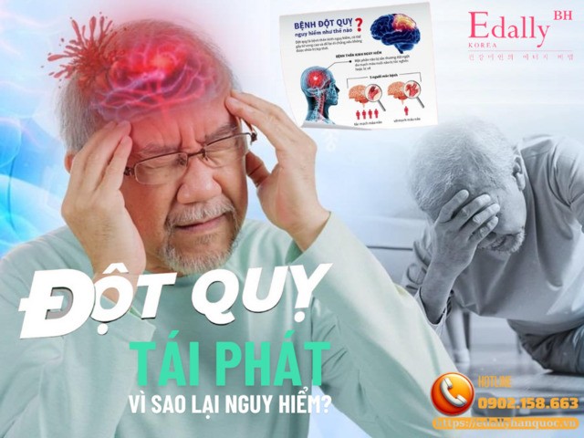 Đột Quỵ Não Tái Phát - Hậu Quả Nặng Nề Hơn So Với Lần Đầu Tiên