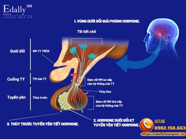 Đột quỵ tuyến yên (pituitary apoplexy) - cập nhật chẩn đoán và điều trị mới nhất