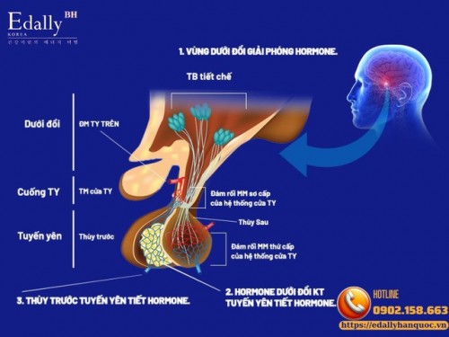 Đột Quỵ Tuyến Yên (Pituitary Apoplexy) - Cập Nhật Chẩn Đoán Và Điều Trị Mới Nhất