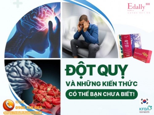 Đột Quỵ Và Những Kiến Thức Có Thể Bạn Chưa Biết