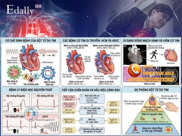 Đột tử do tim ở người trẻ: Từ cơ chế sinh bệnh đến chiến lược chẩn đoán và dự phòng