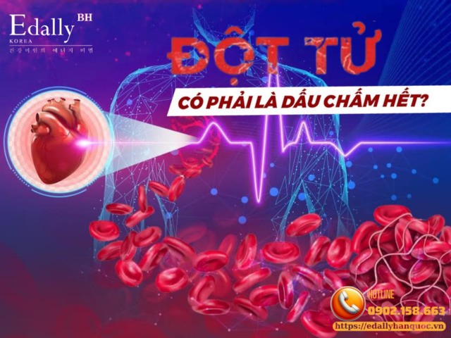 Đột tử (ngừng tim đột ngột) có phải là dấu chấm hết?