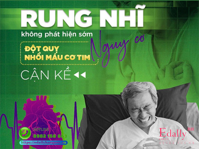 Cách Dự Phòng Đột Quỵ Trên Người Bệnh Rung Nhĩ, Thiếu Máu Não Thoáng Qua