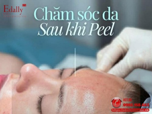 Đừng Bỏ Qua Thời Gian Vàng Chăm Sóc Da Sau Liệu Trình Peel