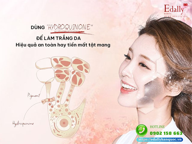 Làm trắng da bằng Hydroquinone - Hiệu quả an toàn hay tiền mất tật mang?