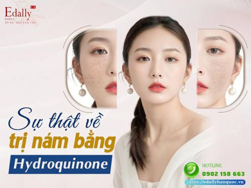 Dùng Hydroquinone Làm Trắng Da - Hiệu Quả, An Toàn Hay Tiền Mất Tật Mang?