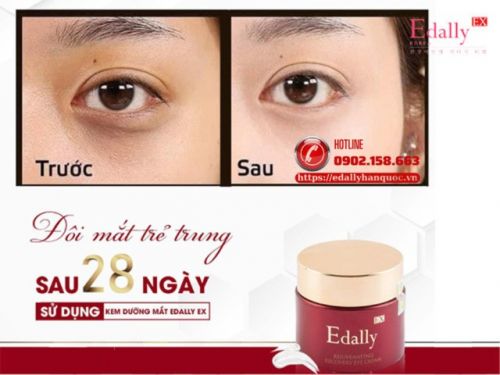 Dùng Kem Dưỡng Mắt Để Làm Gì?
