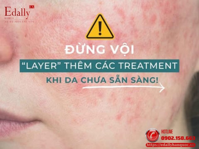 Đừng vội layer thêm các treatment khi da bạn chưa sẵn sàng