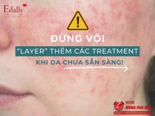 Treatment Chồng Treatment: Bạn Có Từng Hỏi Da Có Muốn Hay Là Không?