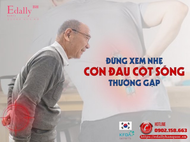 Đừng xem nhẹ cơn đau cột sống thường gặp nếu bạn không muốn phải trả giá