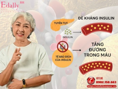 Đường Huyết Cao Và Kháng Insulin: Vì Sao Người Tiểu Đường Dễ Đột Quỵ Gấp 4 Lần?