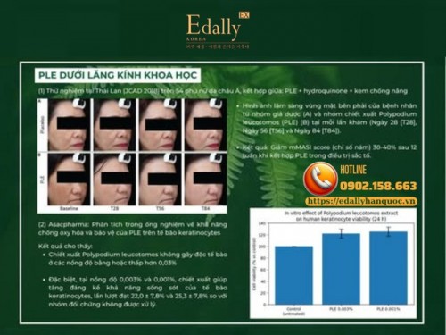 Dương Xỉ (Polypodium Leucotomos - PLE) - Dưới Lăng Kính Khoa Học