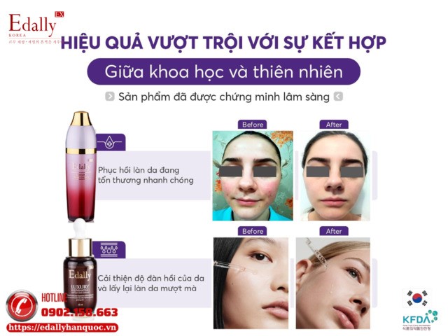 Mỹ phẩm Edally EX Hàn Quốc - Hiệu quả vượt trội với sự kết hợp giữa khoa học và thiên nhiên