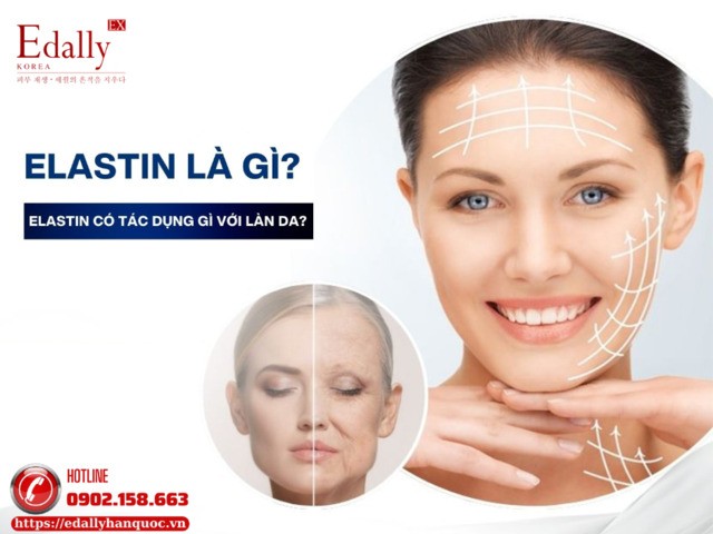 Elastin là gì?