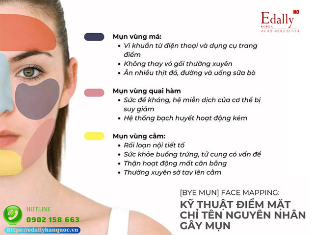 Face mapping: Kỹ thuật điểm mặt chỉ tên nguyên nhân gây mụn vùng má, vùng cằm và vùng quai hàm