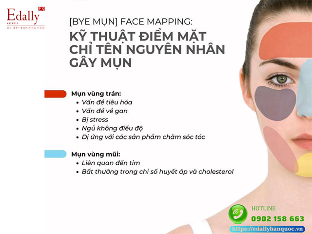 Face mapping: Kỹ thuật điểm mặt chỉ tên nguyên nhân gây mụn vùng trán và vùng mũi