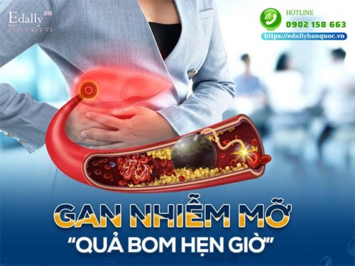 Gan Nhiễm Mỡ Có Nguy Hiểm Không, Có Chữa Khỏi Được Không?