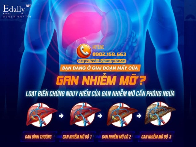 Bạn đang ở giai đoạn mấy của bệnh Gan nhiễm mỡ?