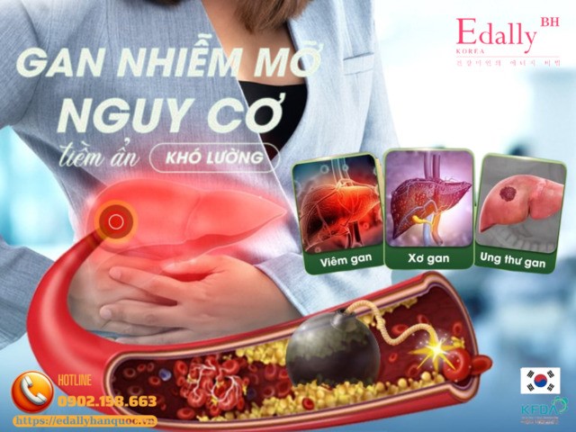 Gan nhiễm mỡ - nguy cơ tiềm ẩn khó lường và phương pháp điều trị