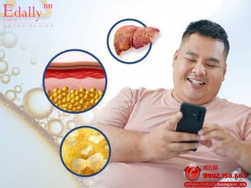 Gan Nhiễm Mỡ, Máu Nhiễm Mỡ Khác Nhau Chỗ Nào Và Mối Liên Hệ Nguy Hiểm Giữa Chúng?