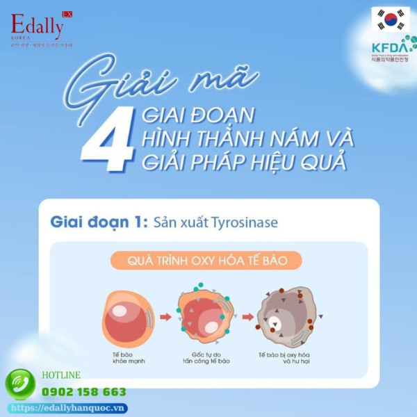 Giai đoạn 1 của quá trình hình thành nám da