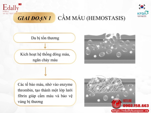 Giai đoạn cầm máu trong cơ chế tự chữa lành của làn da