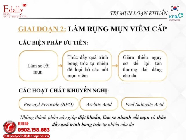 Giai đoạn điều trị mụn loạn khuẩn bằng việc làm rụng mụn viêm cấp