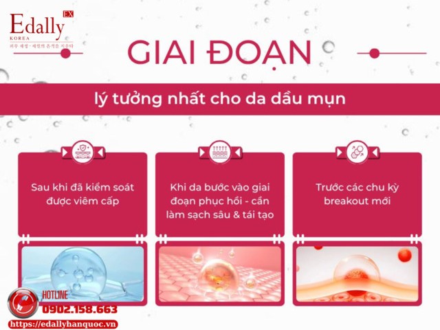 Thời điểm lý tưởng nhất để tiến hành peel cho da dầu mụn