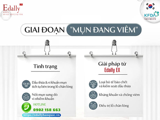 Quy trình phát triển của mụn và cơ chế xử lý mụn ở giai đoạn mụn đang viêm từ Mỹ phẩm Edally EX Hàn Quốc