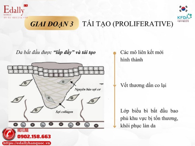 Giai đoạn tái tạo trong cơ chế tự chữa lành của làn da