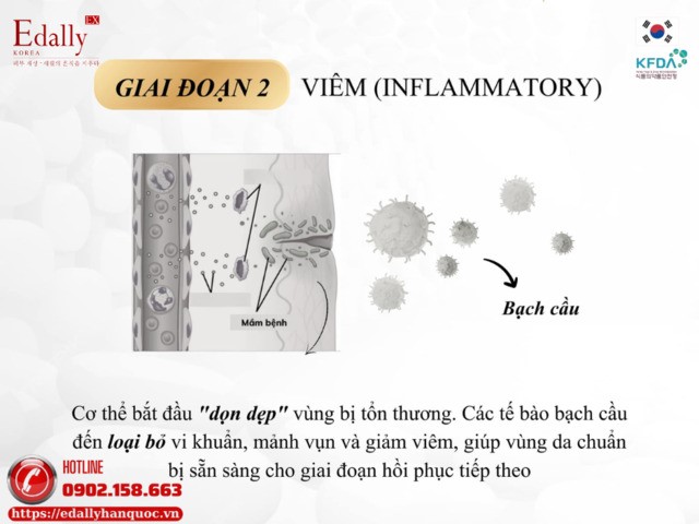 Giai đoạn viêm trong cơ chế tự chữa lành của làn da