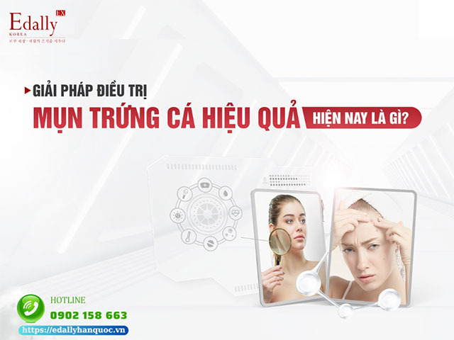 Giải pháp điều trị mụn trứng cá ở người trưởng thành hiệu quả là gì?