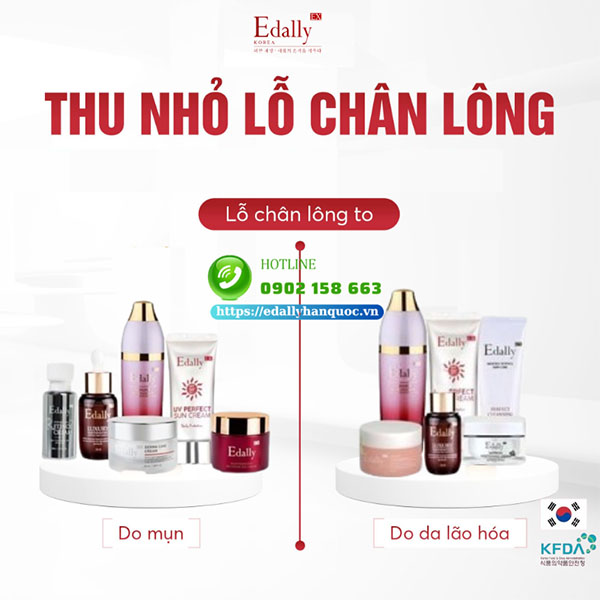 Giải pháp thu nhỏ lỗ chân lông to ở mặt hiệu quả tại nhà cùng Mỹ phẩm Edally EX Hàn Quốc