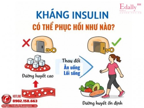 Giảm Kháng Insulin - Chìa Khóa Gốc Rễ Để Phục Hồi Chuyển Hóa, Ổn Định Đường Huyết