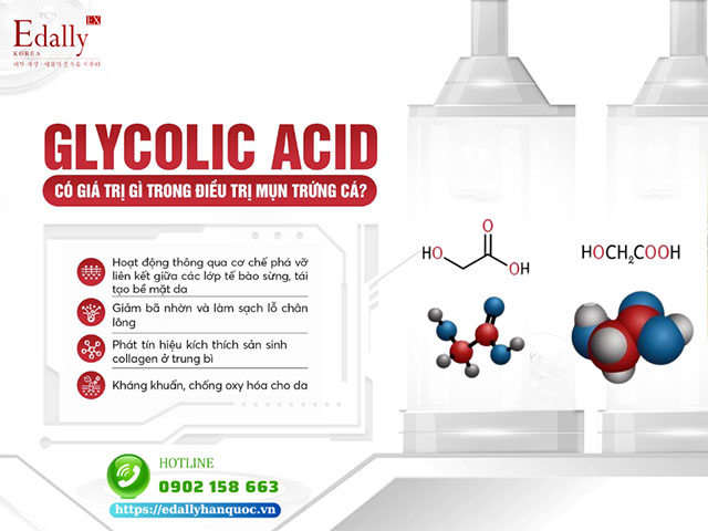 Glycolic Acid có giá trị gì trong điều trị mụn trứng cá?