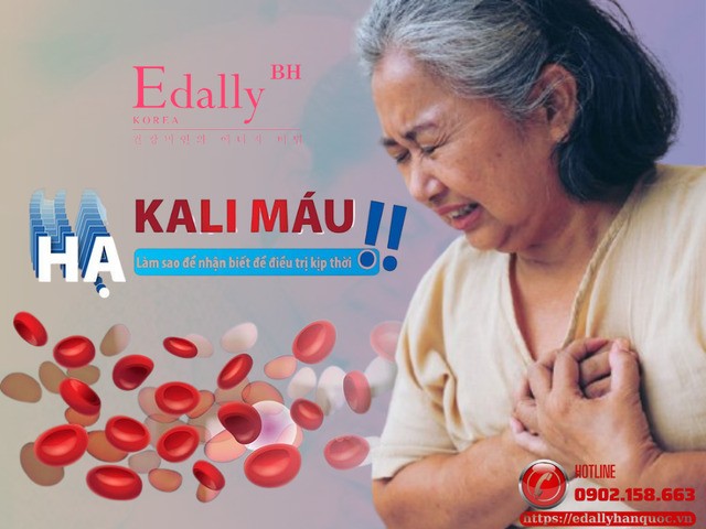 Hạ Kali Máu: Nguyên Nhân, Triệu Chứng Và Cách Điều Trị