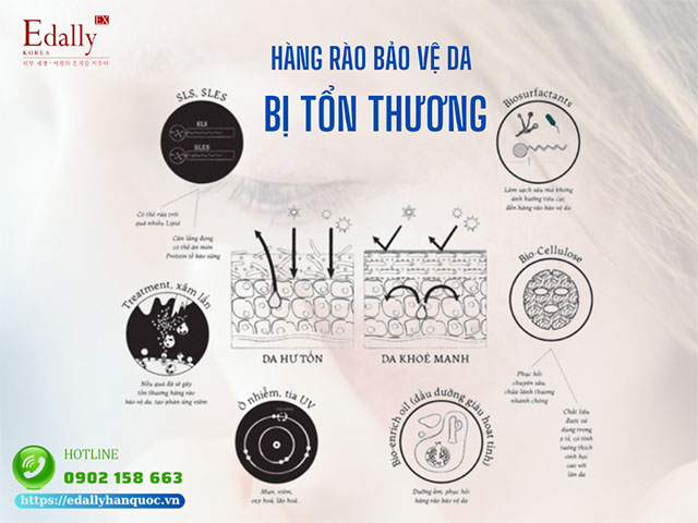 Hàng rào bảo vệ da bị tổn thương và khả năng phục hồi