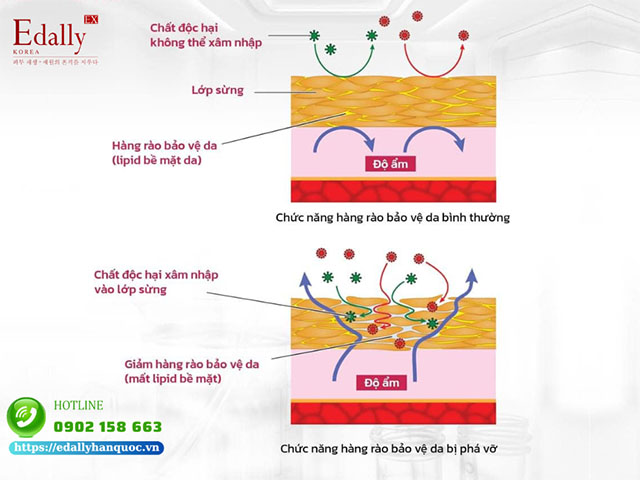 Hàng rào bảo vệ da liên quan mật thiết đến hiệu quả của việc dưỡng ẩm và khóa ẩm cho da