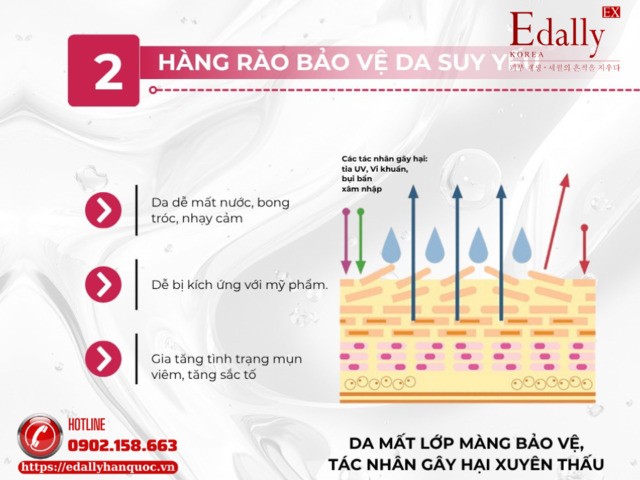 Hàng rào bảo vệ da bị suy yếu